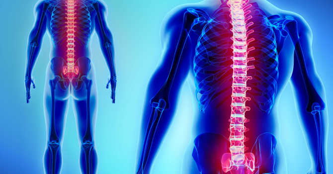 Spinal Cord Injuries image